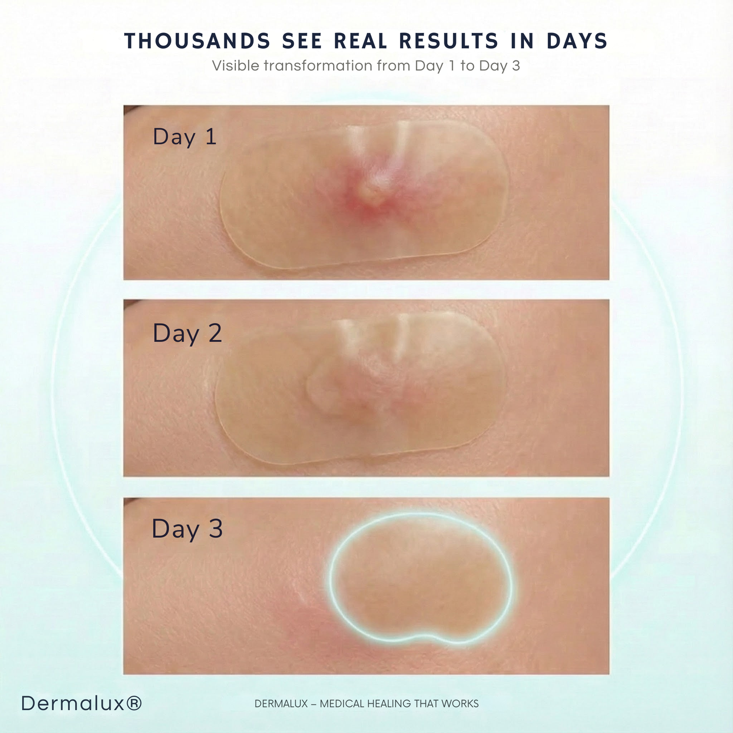 DermaTape™ | Patches for Scars and Acne